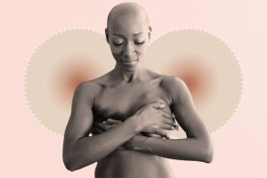 breast-cancer-GettyImages-554200195-b7787c514a9540f794281d62274343b2